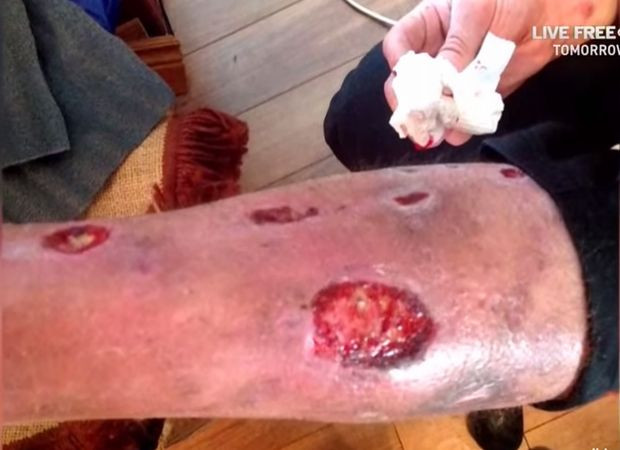 Droga "krokodil" hara Hrvatskom! | BN