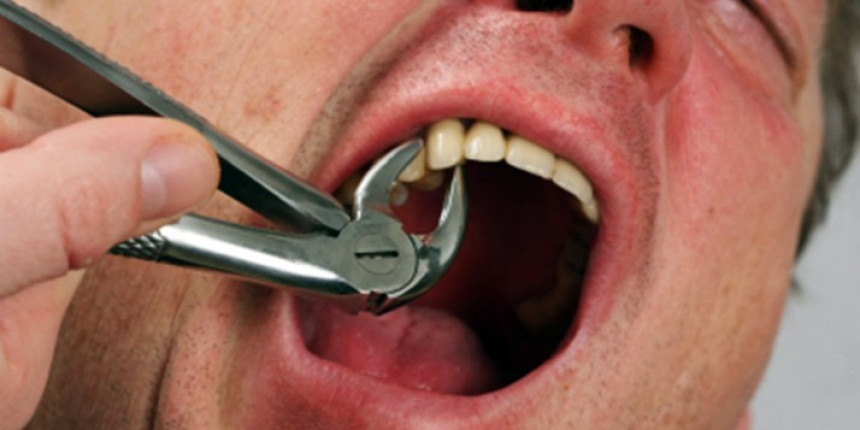 Čistač se lažno predstavio kao zubar i izvadio čoveku 4 zuba!