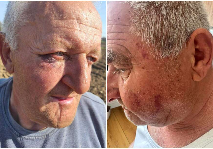 Banjaluka: Policijska brutalnost nad penzionerima?!
