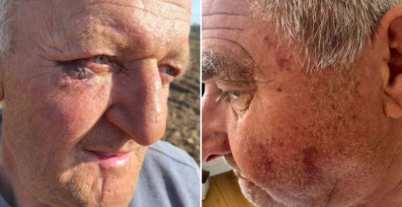 Banjaluka: Policijska brutalnost nad penzionerima?!