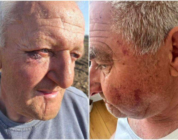 Banjaluka: Policijska brutalnost nad penzionerima?!