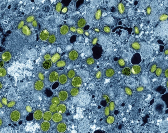 Epidemija malih boginja u Bangladešu odnosi živote