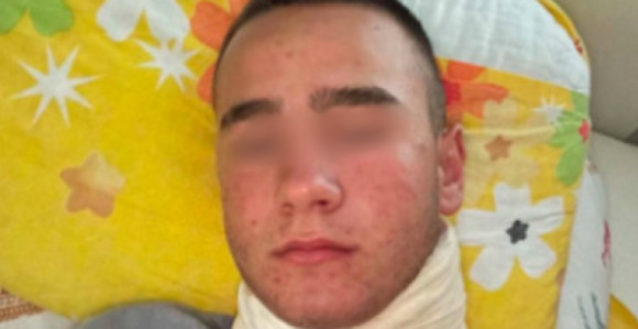 Policiji naloženo da ispita sve u vezi premlaćivanja dječaka