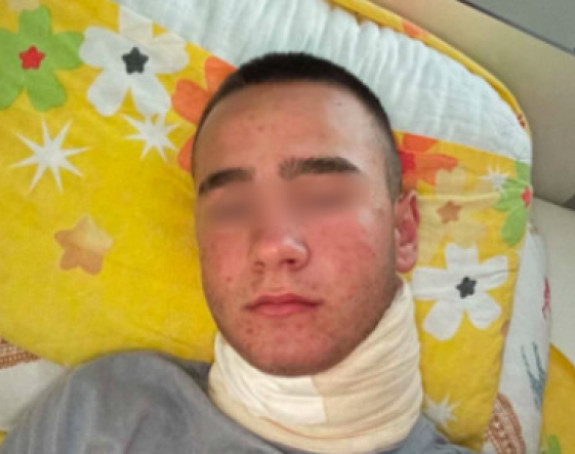 Policiji naloženo da ispita sve u vezi premlaćivanja dječaka