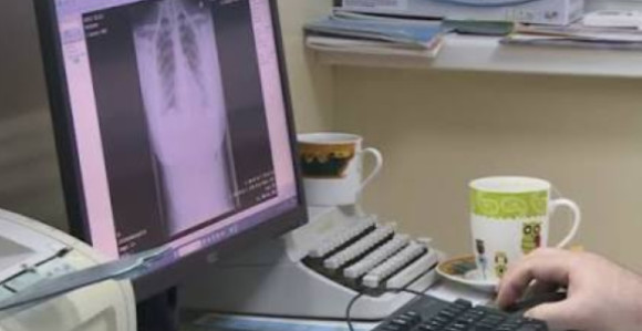 Službenike šalju privatnicima, a javni sistem propada