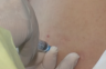 Обустава употребе БЦГ вакцине у Републици Српској