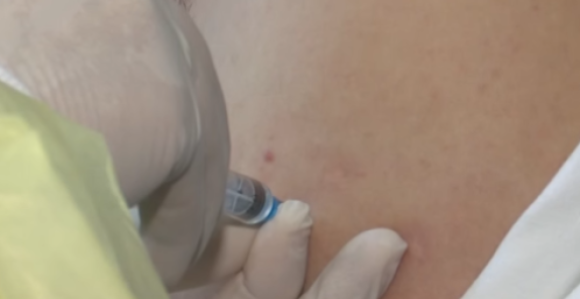 Obustava upotrebe BCG vakcine u Republici Srpskoj