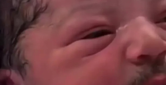 Beba rođena sa brkovima i bradom (foto, video)