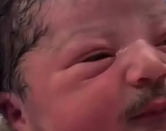 Beba rođena sa brkovima i bradom (foto, video)