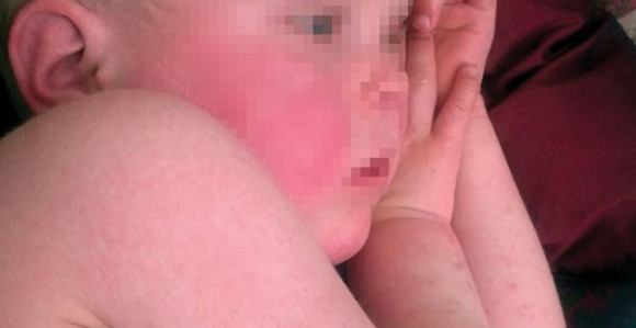 Šarlah se vraća na velika vrata?!