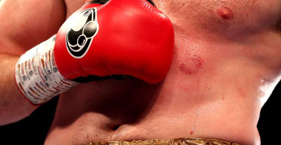 Momak baš ima jak ugriz!