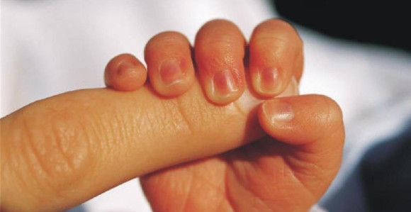 Dječak spriječio otmicu novorođene sestre