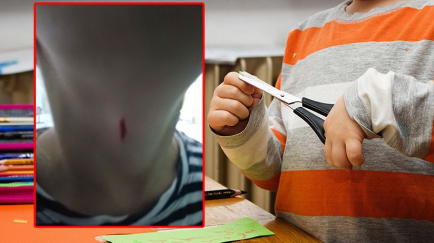 Dječak povrijedio djevojčicu makazama 