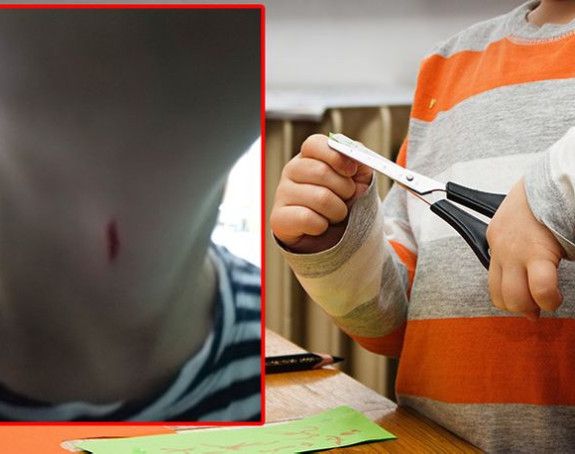 Дјечак повриједио дјевојчицу маказама 