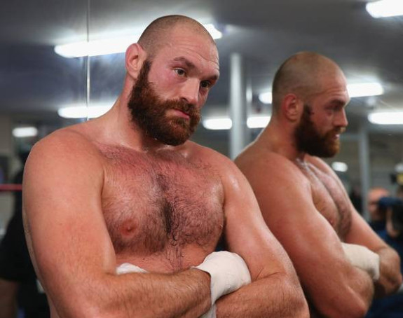 Fjuri: Ko to kaže da sam homofob?! Nisam!