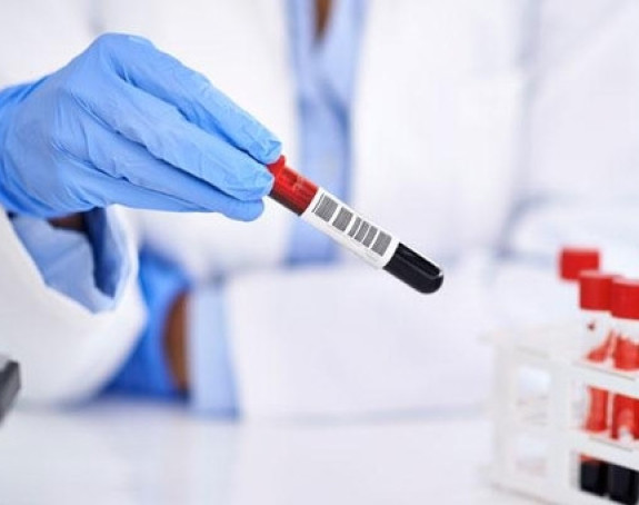 Bez simptoma HIV-a se živi i do 10 godina