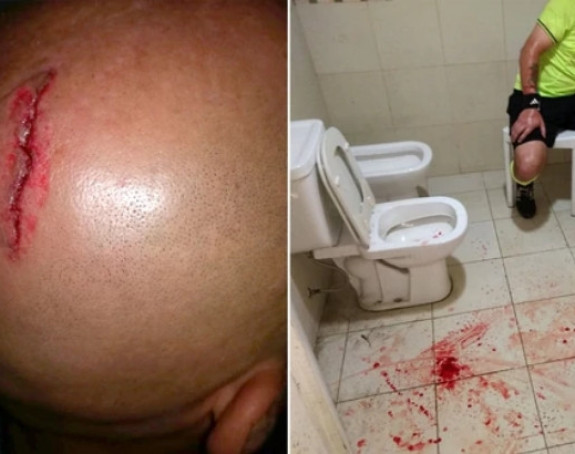 Video: Navijači prebili sudiju i "pocijepali" mu glavu!