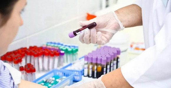 Za godinu dana 10 novooboljelih od HIV/AIDS-a