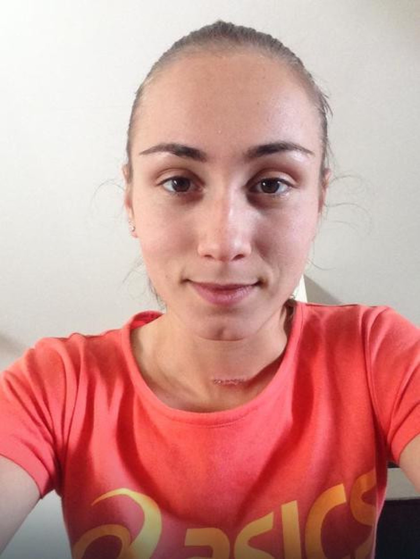 Aleksandra Krunić operisala dobroćudni tumor na štitnoj žljezdi!