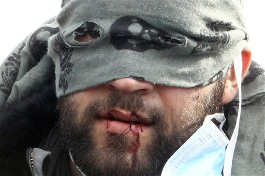 Francuska: Iranci zašili usta u znak protesta