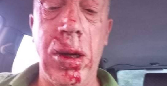 Brutalno pretučen u centru Teslića