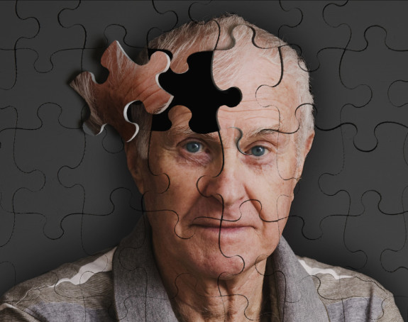 Lijek za Alchajmerovu bolest nikad bliži