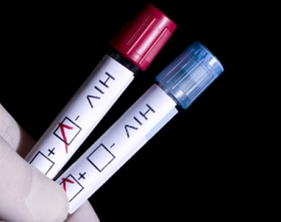 Panika u Rusiji: Grad pokošen HIV-om