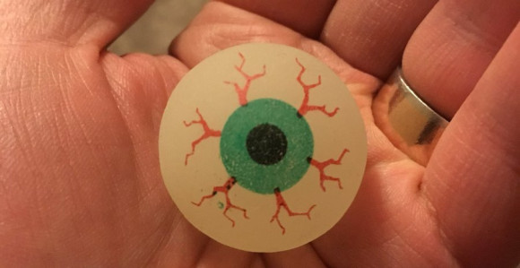 Bizarni Škoti! Bacili vještačke oči na teren!