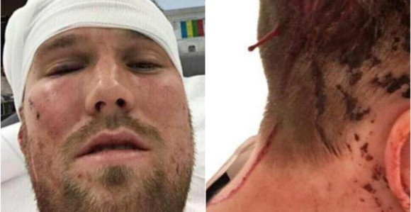 "Švabe" u bolnici otpustile pretučenog Groskrojca!