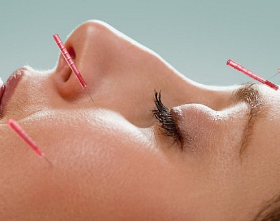 Ubodi u 400 tačaka na tijelu smanjuju bol