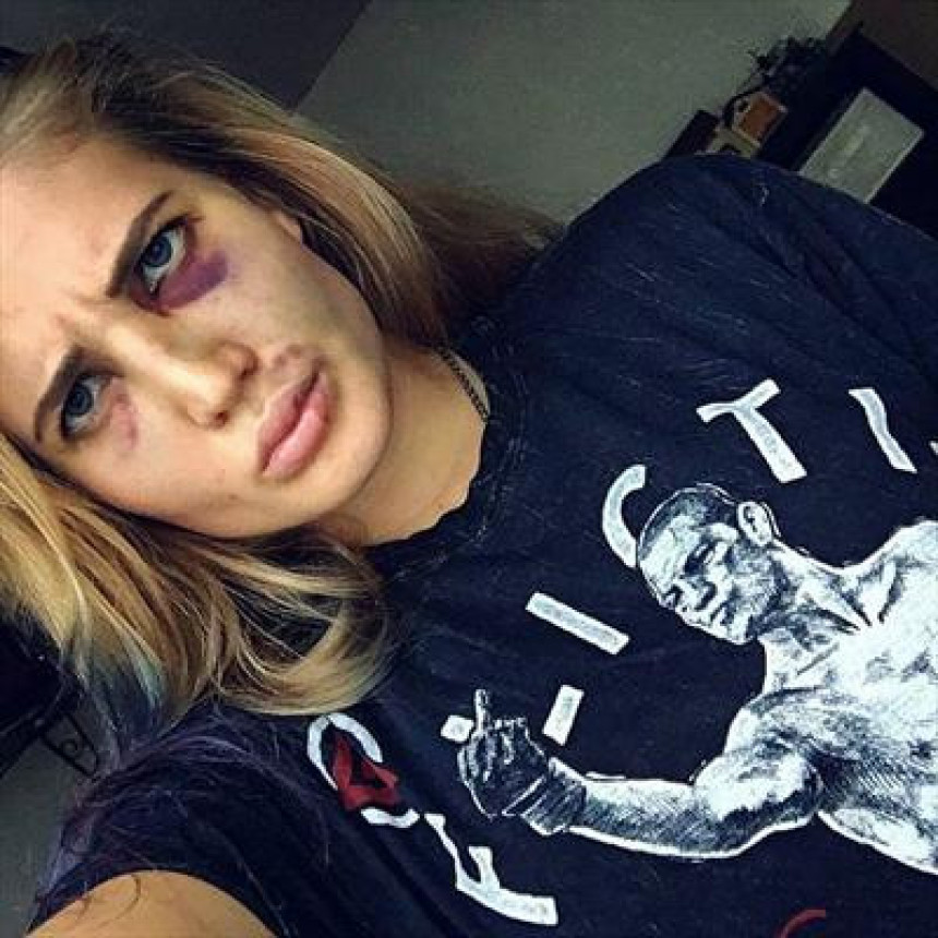 Surovi MMA: Ruskoj ljepotici je u oktagonu stradalo lice, ali neće da odustane! 
