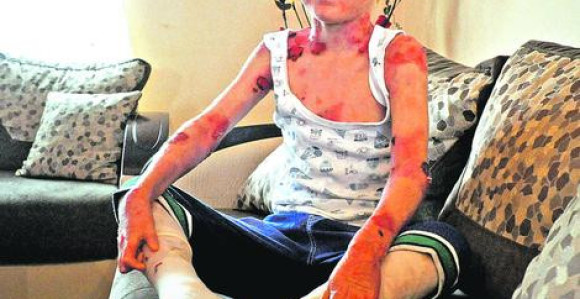 Tužan život dječaka "leptira" iz B. Bašte