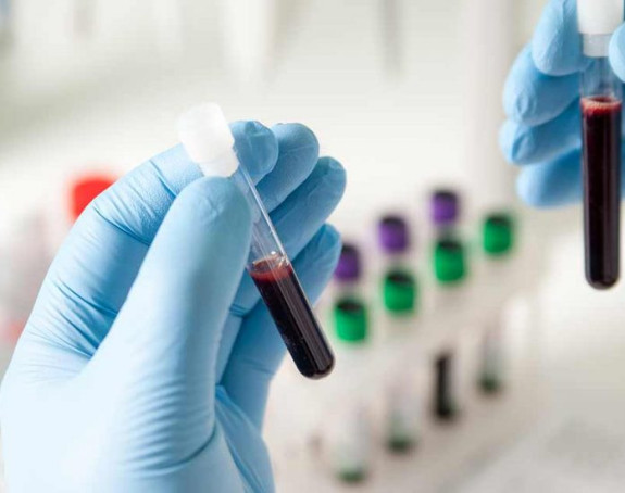 Brzi test na sve karcinome