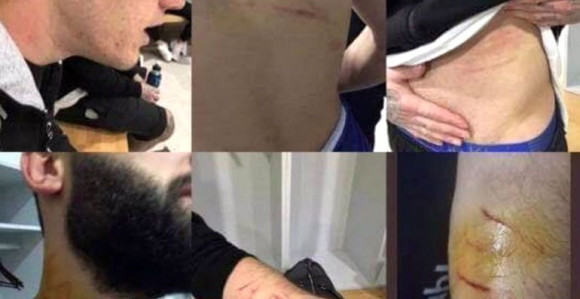 Krvavi pir turskog fudbalera!