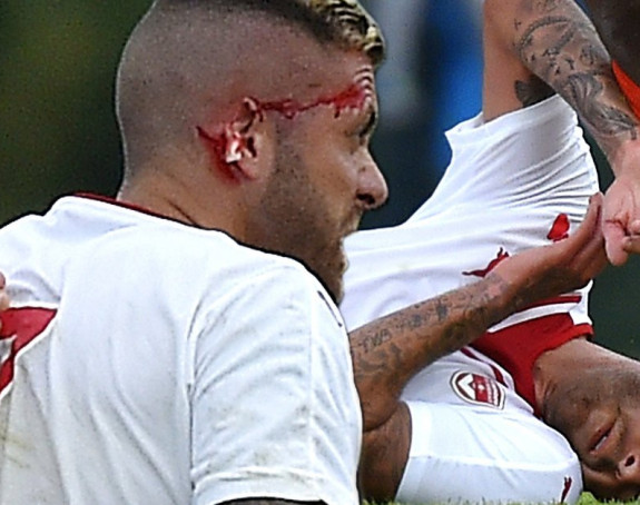 Užas! Žeremi Menez ostao bez dela uha!