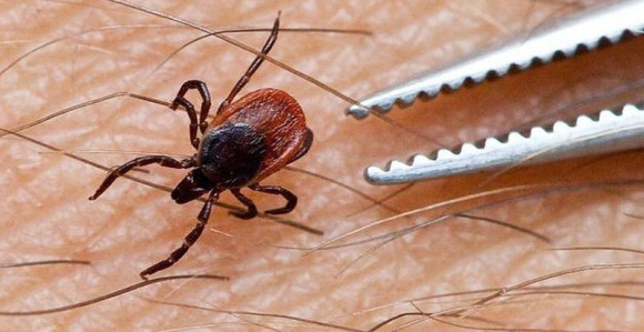 У Српској 57 обољелих од лајмске болести