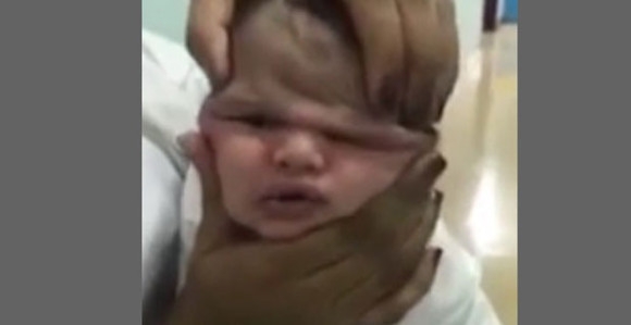 Stiskali bebi glavu i snimale