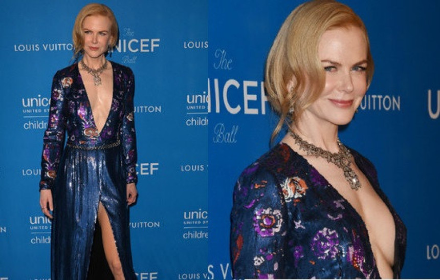 Nikol Kidman izvadila silikone iz grudi