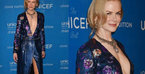 Nikol Kidman izvadila silikone iz grudi