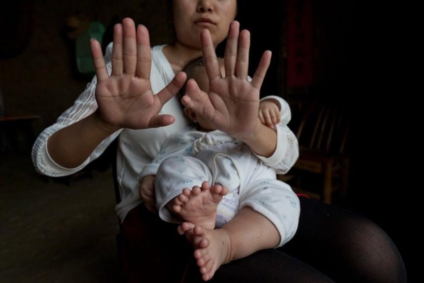 Беба у Кини рођена са 15 прстију на рукама