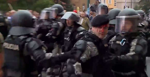 Policija napala novinara TV1