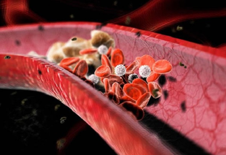 10 zanimljivih činjenica o holesterolu