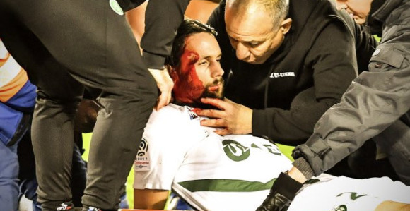 Stravična povreda Nevena Subotića!