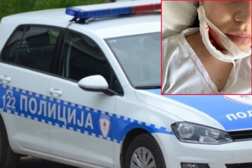Djevojci čašom polomio vilicu