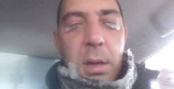 Heroj sa zaleđenim trepavicama