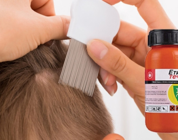 Sredstva protiv vaški "kvare djecu"?