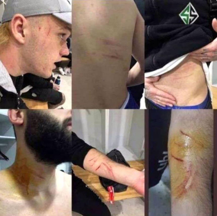 Turski fudbaler suspendovan doživotno!