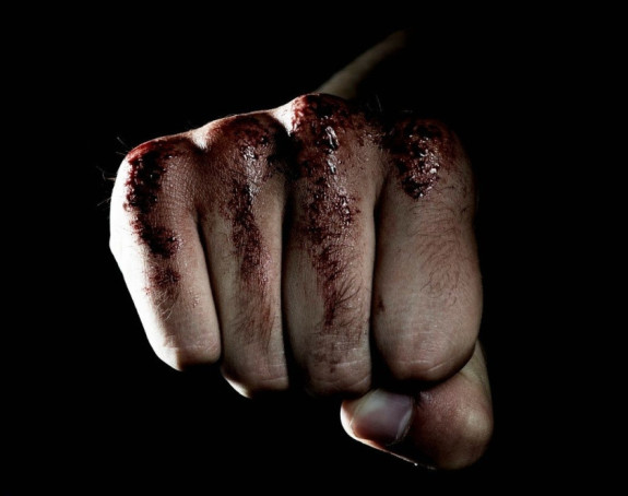 Потукли се пунац и зет у Цазину