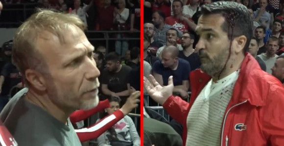 Milan Kalinić o tuči sa Zvezdinim navijačem...