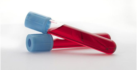 Nepotrebna upotreba antibiotika biće eliminisana testom krvi?